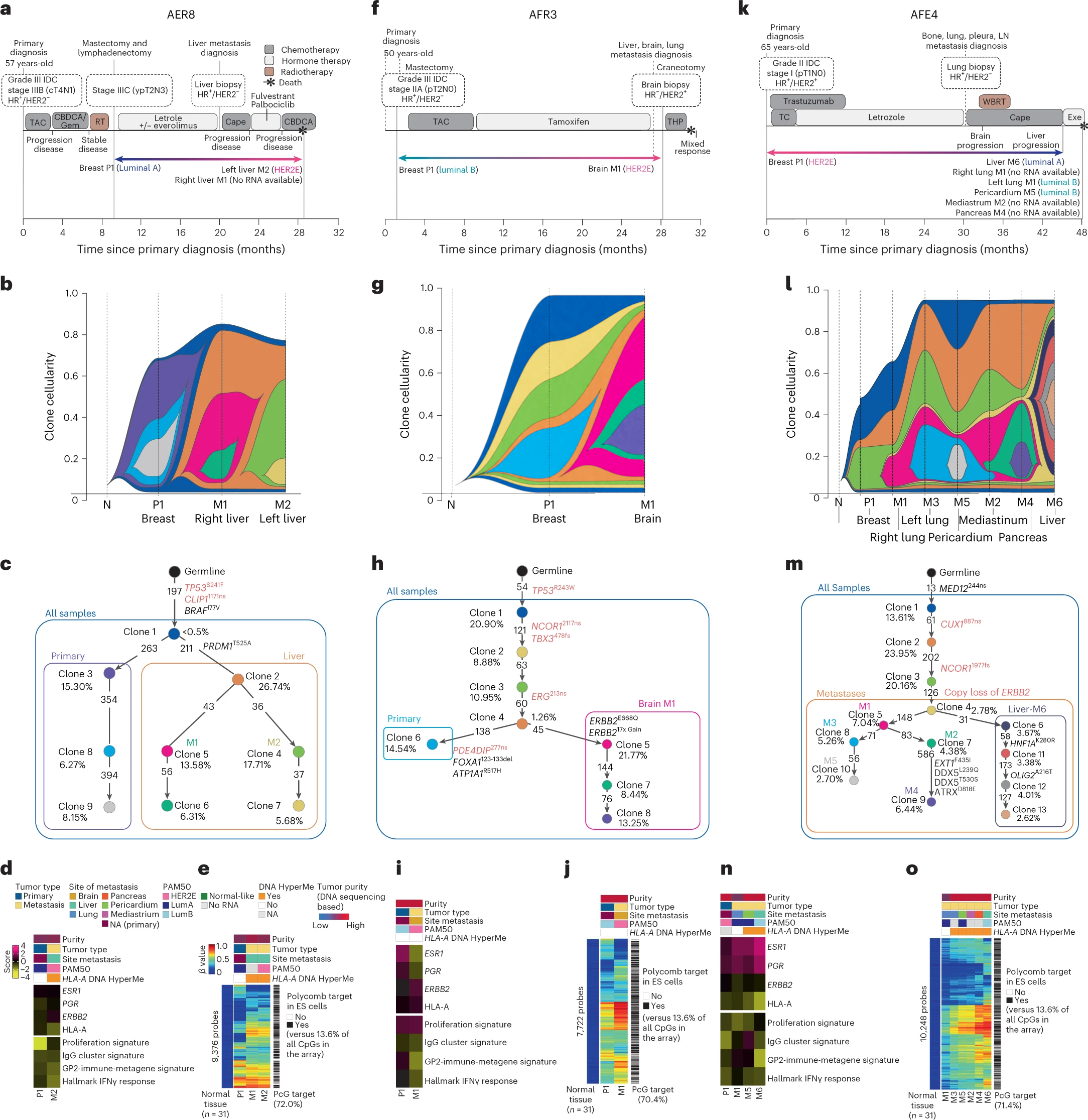 Vignettes showing evolutionary processes within multiple tumor metastatic sites in breast cancer. 