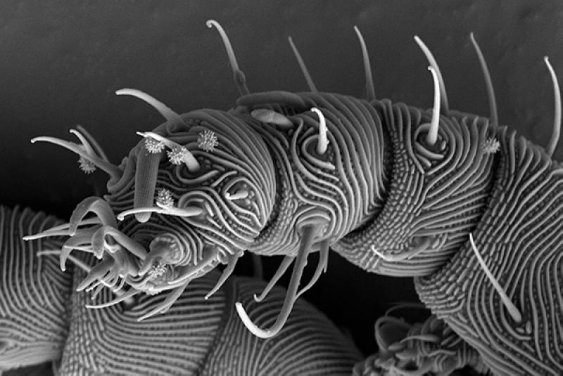 SEM of mite leg