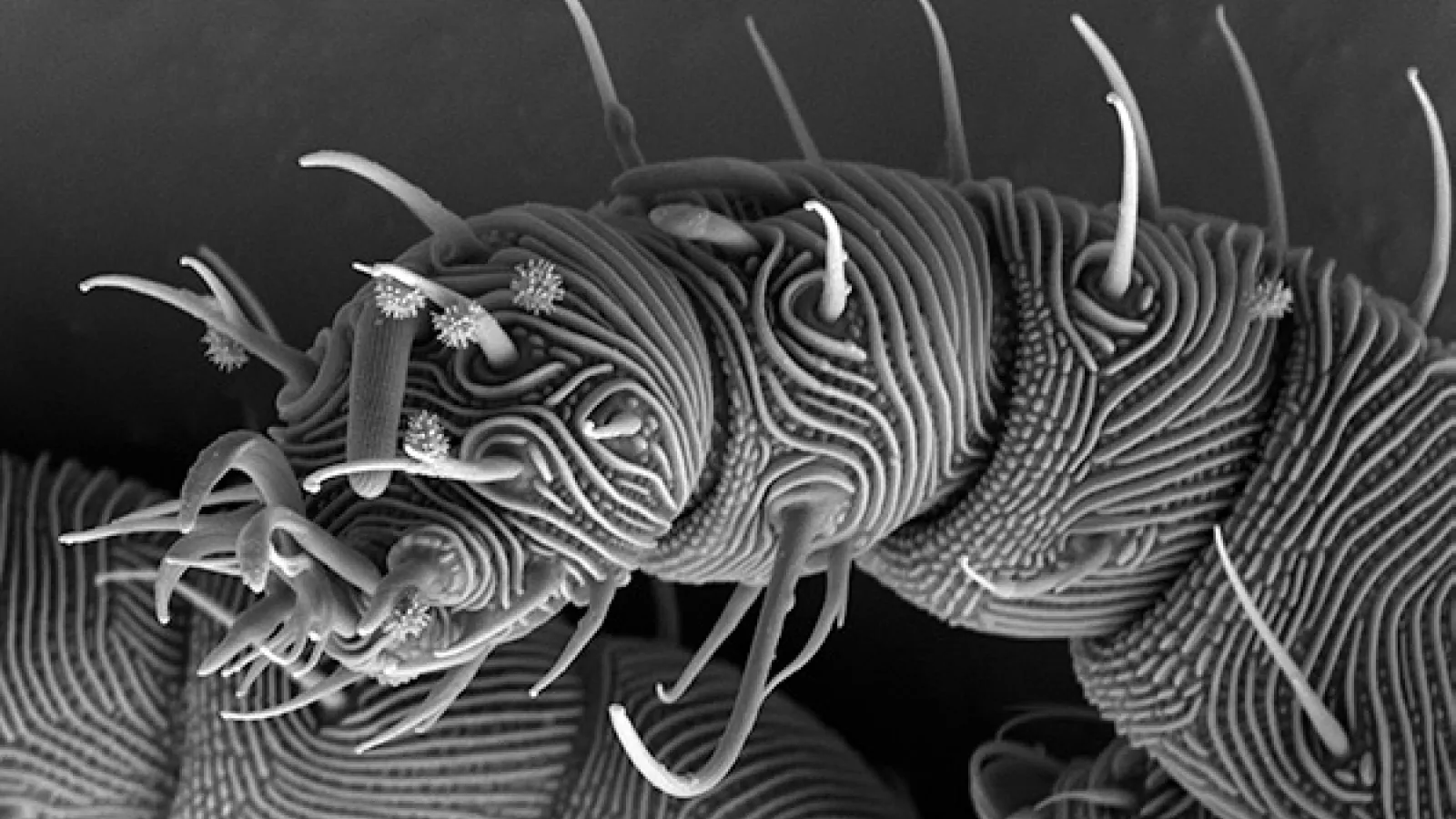 SEM of mite leg