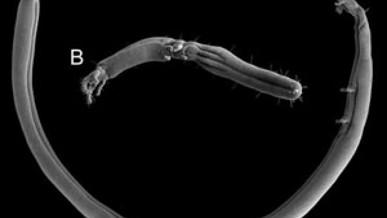Black & white EM image of Gordialycus