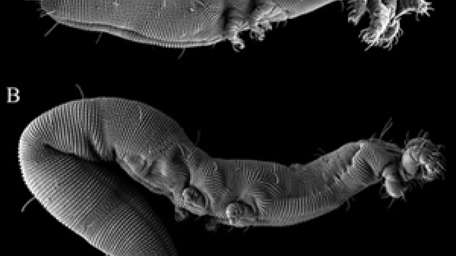 electron micrograph of Osperalycus tenerphagus, a new genus and species of Nematalycidae