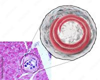 enlargement of trichinella embedded in muscle fiber on prepared slide