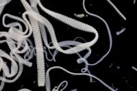 tapeworm magnified with individual proglottids visible