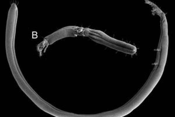 Black & white EM image of Gordialycus