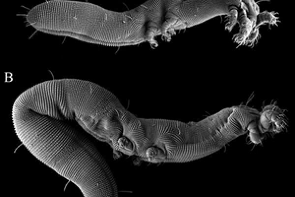 electron micrograph of Osperalycus tenerphagus, a new genus and species of Nematalycidae