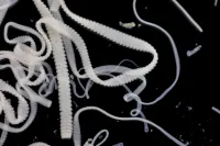 tapeworm magnified with individual proglottids visible